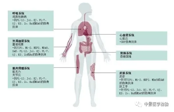 抗肌炎抗体谱检测 图片